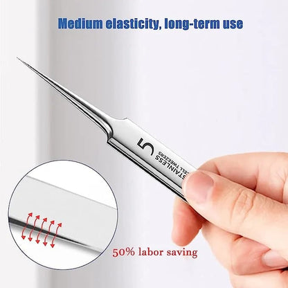 ✨LAST DAY 70% off💥Professional Facial Blackhead Remover Tweezers