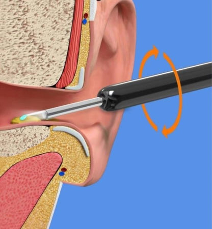 👂50% OFF ! Wireless WIFI Visual Ear Pick【Flash Sale】🔥
