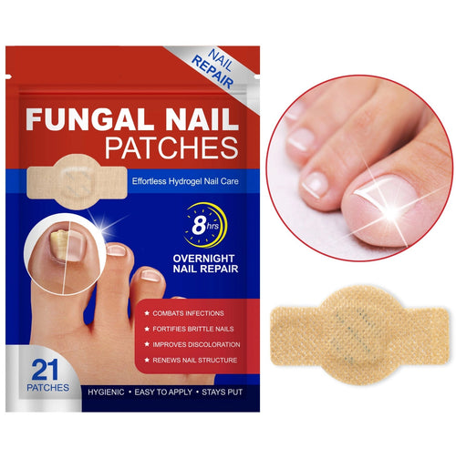 Fungal Nail Patches -- Fast, Effective, Long-Lasting, 21 Pcs / Set