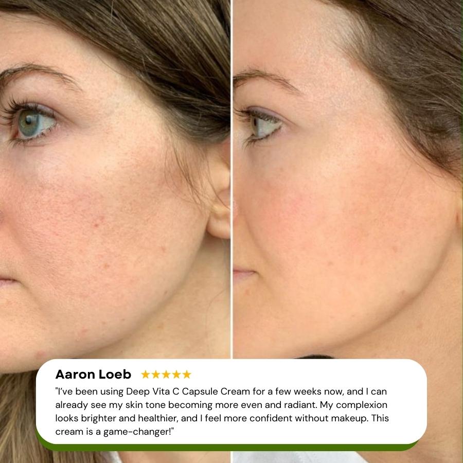 🔥Glow Capsule Cream💥20% OFF Deal