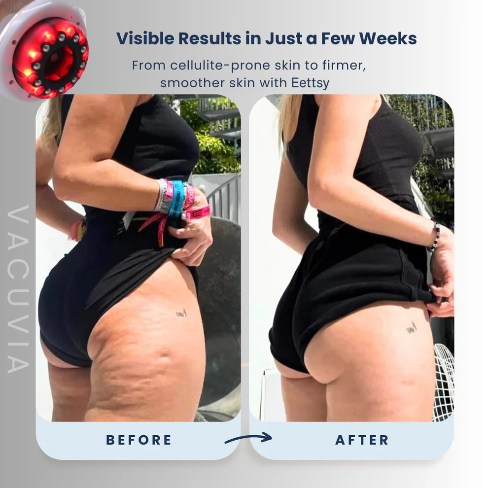 Eettsy® Firmer, More Toned Skin