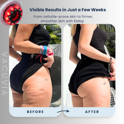 Eettsy® Firmer, More Toned Skin