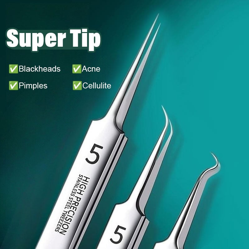 ✨LAST DAY 70% off💥Professional Facial Blackhead Remover Tweezers
