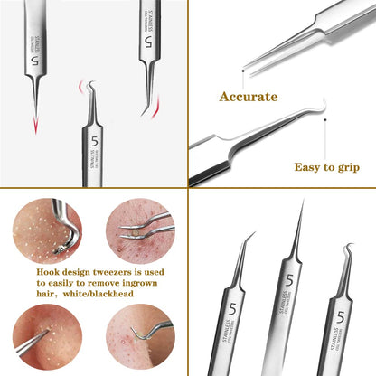 ✨LAST DAY 70% off💥Professional Facial Blackhead Remover Tweezers