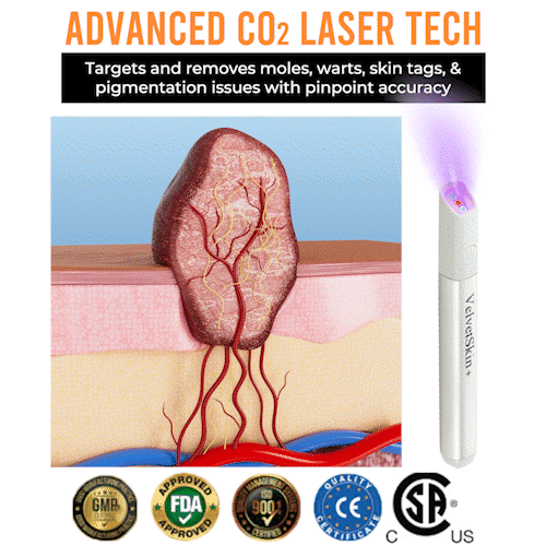 ✨ All-in-One CO₂ Laser Eraser Pen | Removes Moles, Warts, Skin Flaws & Pigmentation
