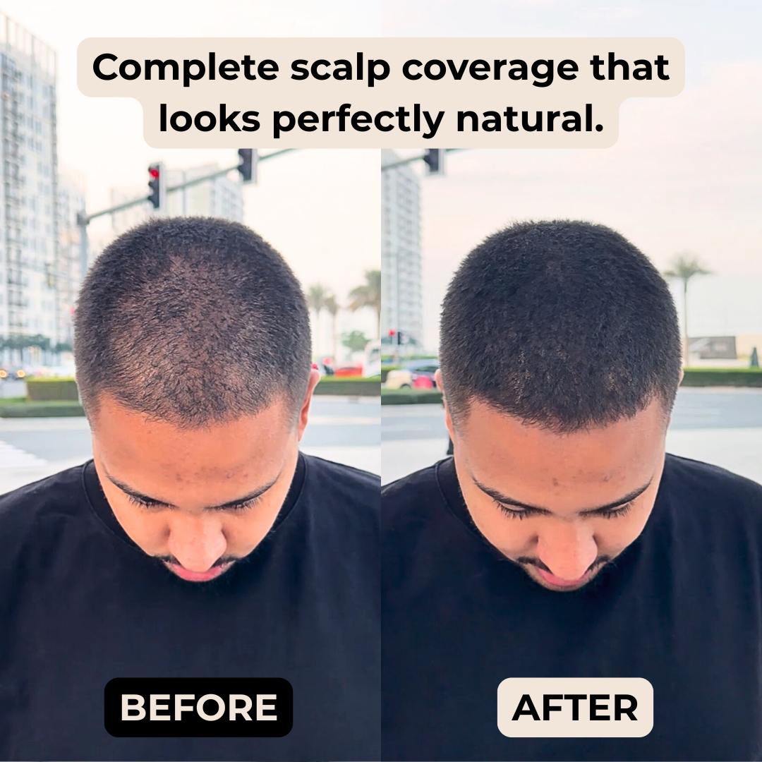 Hairup By Mytrendyes