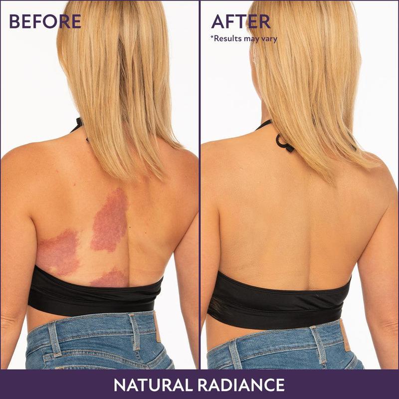 💫Last Day Promotion✨Beauty Body Coverage Perfector – Waterproof, lightweight & flawless body makeup