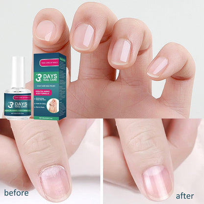 🔥3 Days Nail Care Formula--16ml Nail Care Oil with Keratin