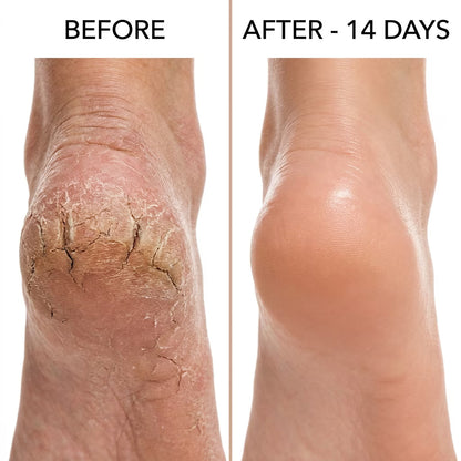 🔥Last Day - 49% OFF🔥Healing Therapy Gel Socks✨