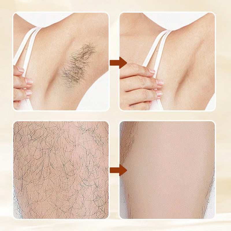 💖Last Day 70% OFF✨5-Minute Painless Hair Removal Cream for Sensitive Skin