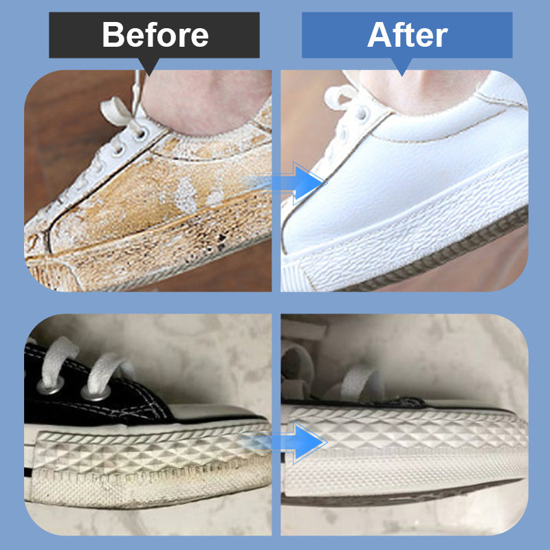 ⏰🔥LIMITED TIME 50% OFF! 👟 Portable Shoe Stain Remover Kit✨💦