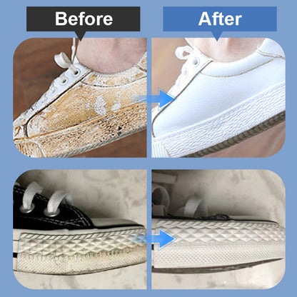 ⏰🔥LIMITED TIME 50% OFF! 👟 Portable Shoe Stain Remover Kit✨💦